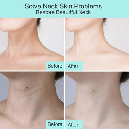 Crema Reafirmante Para Cuello Antiarrugas Vitamica C Retinol