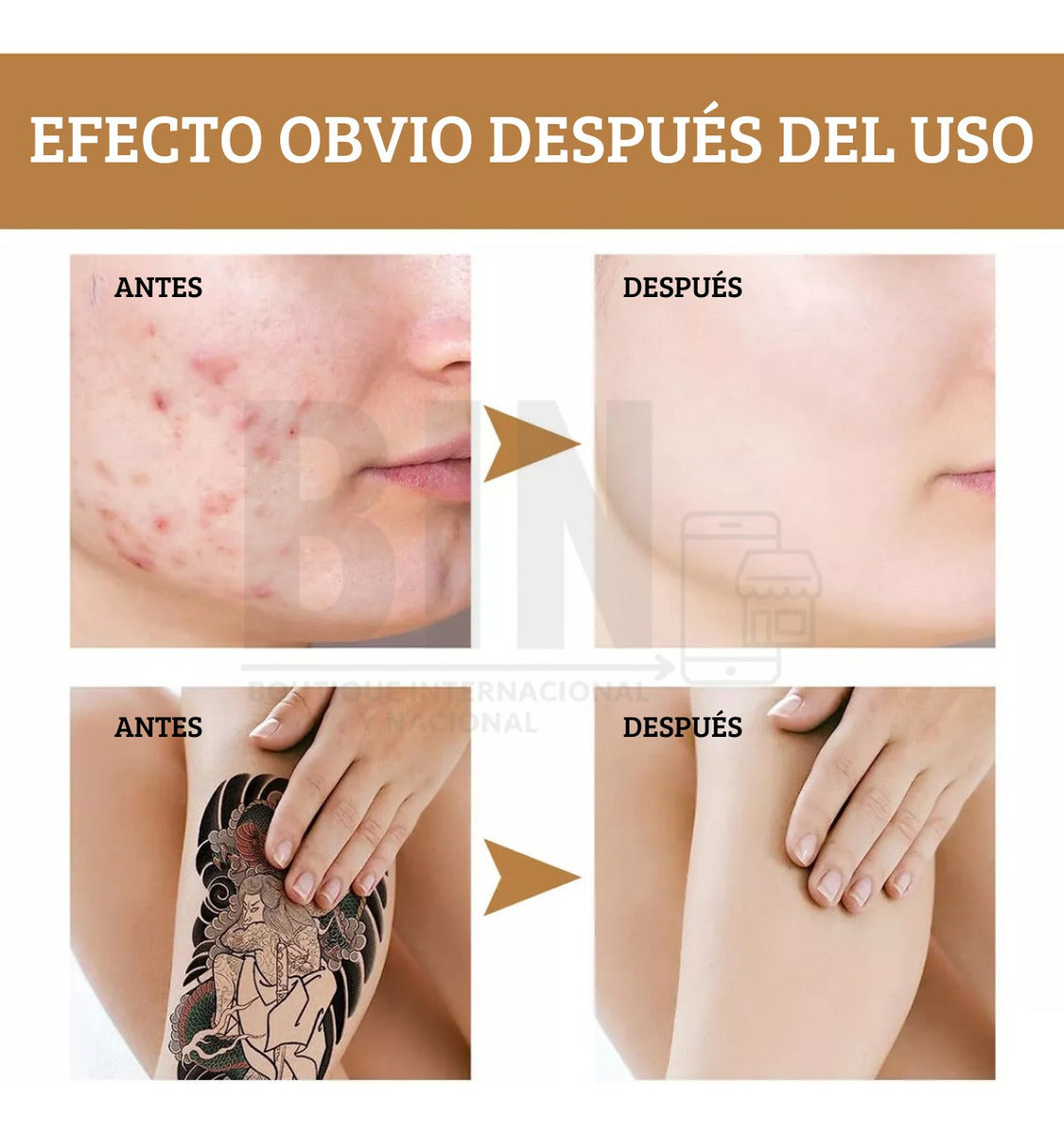 Corrector de Alta Cobertura | Oculta Manchas + Disimula Tatuajes + Acabado Natural + Fórmula Impermeable + Larga Duración
