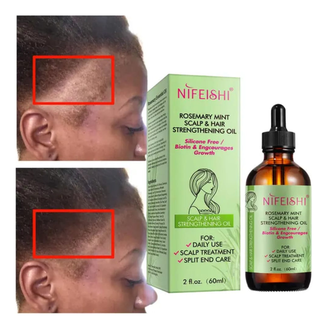 Aceite de Romero para Crecimiento Capilar | Fortalece Cabello + Estimula Pestañas | Nutrición Natural + Resultados Visibles | Kit 2