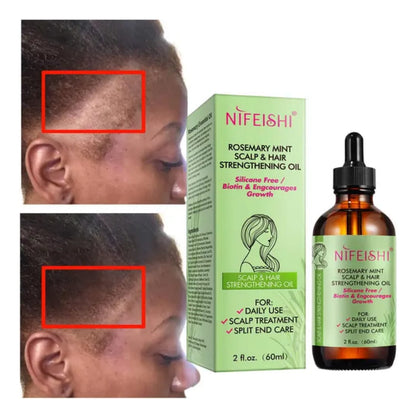 Aceite de Romero para Crecimiento Capilar | Fortalece Cabello + Estimula Pestañas | Nutrición Natural + Resultados Visibles | Kit 2