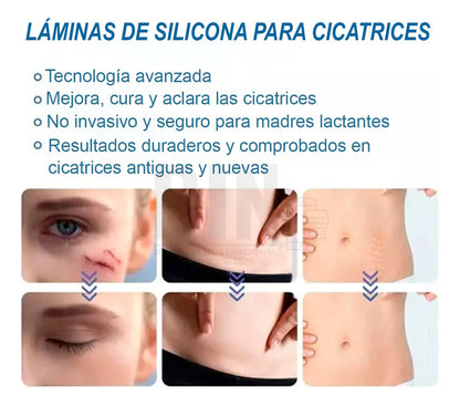 Parche De Silicona Para Cicatrices Recortable Reutilizable