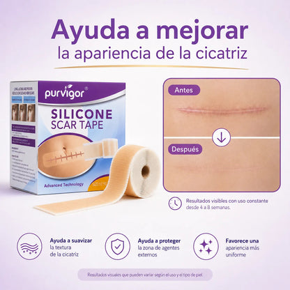 Rollo Silicona Para Cicatrices 3m Purvigor Reutilizable