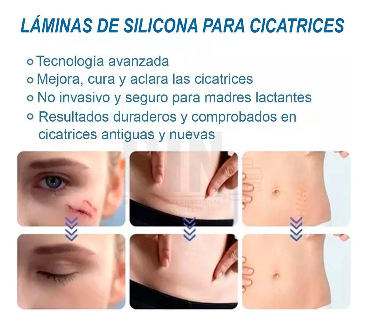 Parche De Silicona Para Cicatrices Recortable Reutilizable