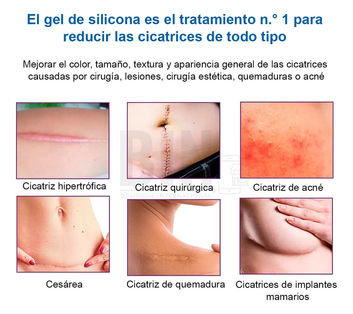 Parche De Silicona Para Cicatrices Recortable Reutilizable