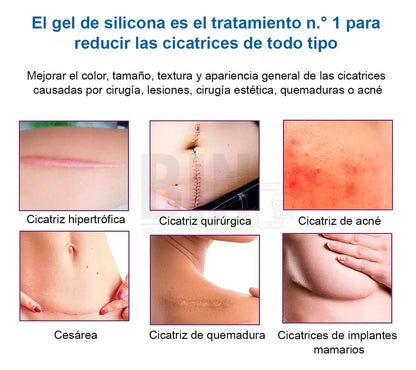 Parche De Silicona Para Cicatrices Recortable Reutilizable