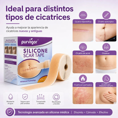 Rollo Silicona Para Cicatrices 3m Purvigor Reutilizable
