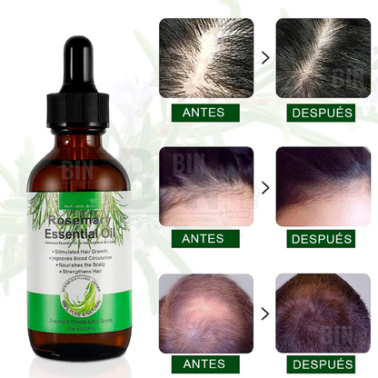 Aceite Esencial de Romero para Cabello y Piel
