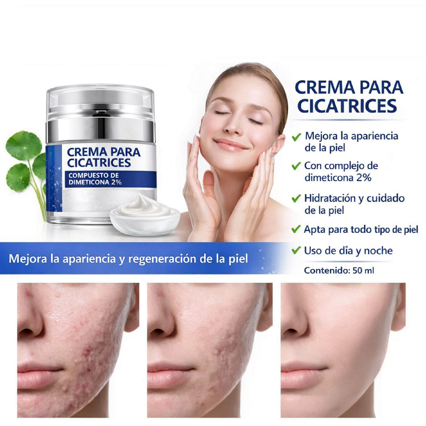 Elaimei Crema Antiacné para Marcas y Cicatrices Queloides – Cuidado Facial 50 ml