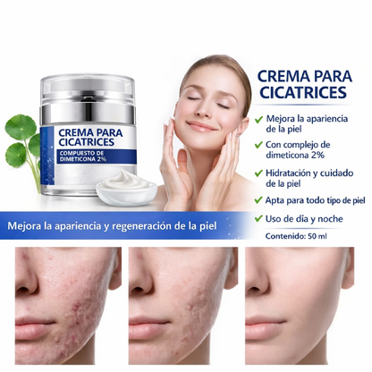 Elaimei Crema Antiacné para Marcas y Cicatrices Queloides – Cuidado Facial 50 ml