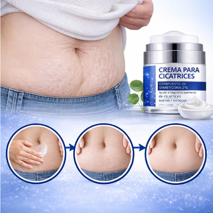 Elaimei Crema Antiacné para Marcas y Cicatrices Queloides – Cuidado Facial 50 ml