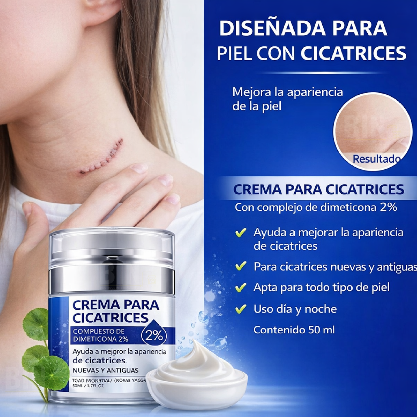 Elaimei Crema Antiacné para Marcas y Cicatrices Queloides – Cuidado Facial 50 ml