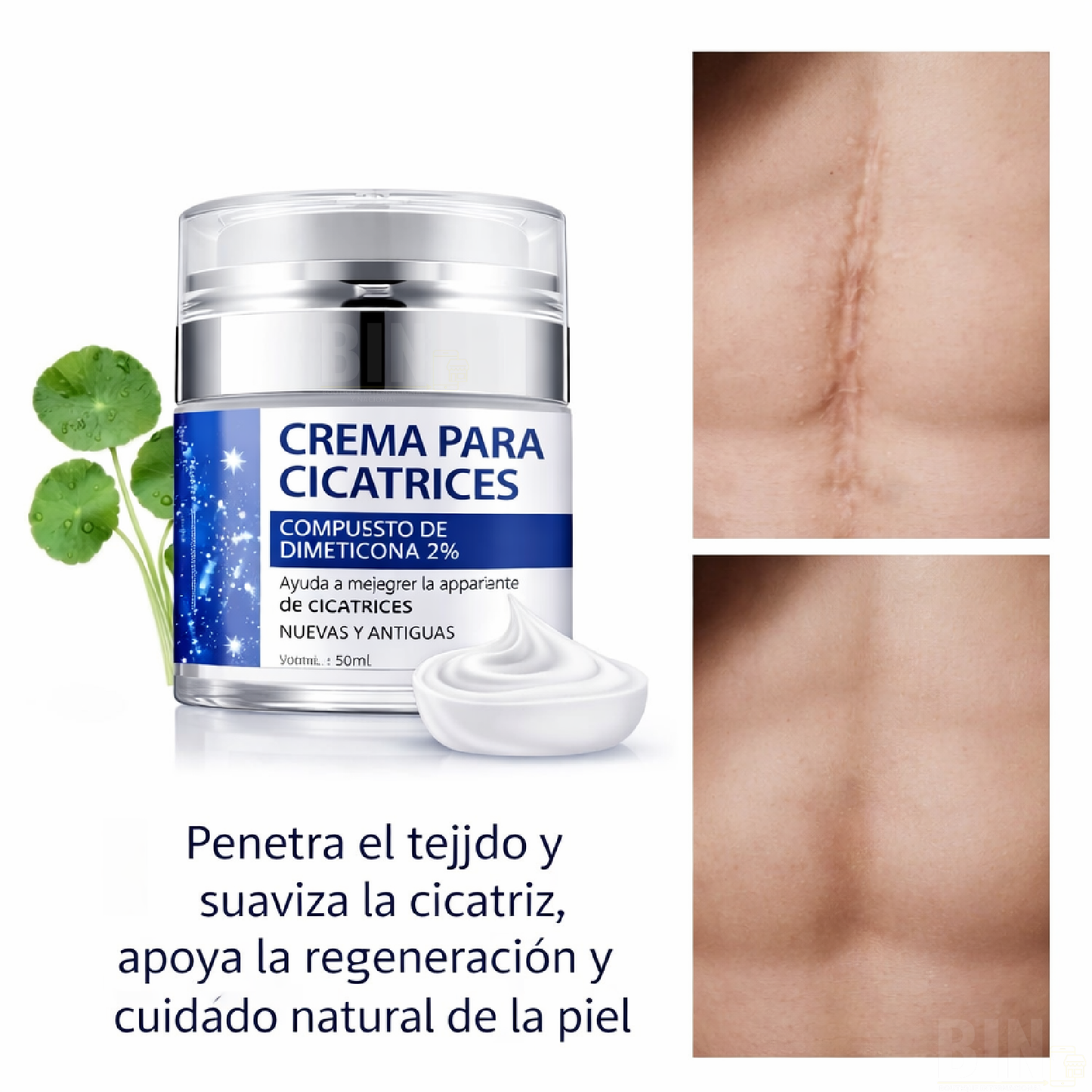 Elaimei Crema Antiacné para Marcas y Cicatrices Queloides – Cuidado Facial 50 ml