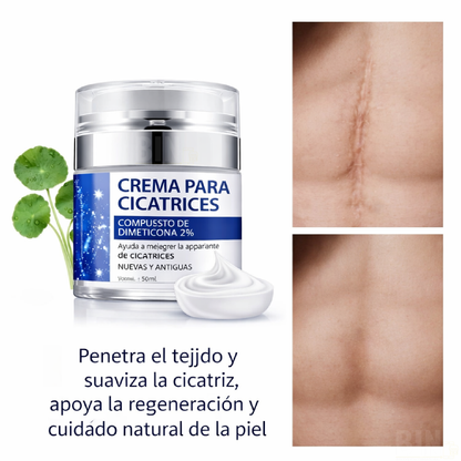 Elaimei Crema Antiacné para Marcas y Cicatrices Queloides – Cuidado Facial 50 ml
