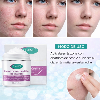 Crema Reparadora Elaimei para Cicatrices y Manchas 50ml