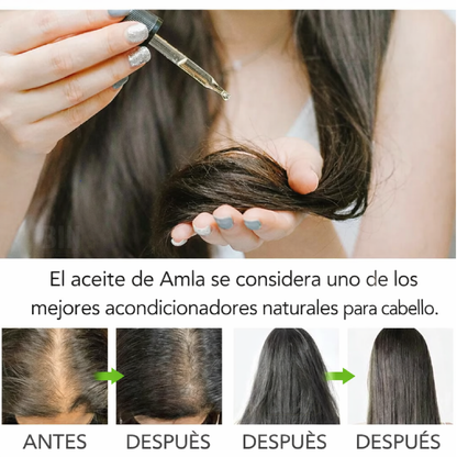 Aliver Aceite de Amla para el Cabello Anticaída Fortalece Folículos y Estimula Crecimiento Capilar