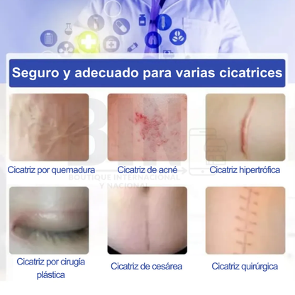 Elaimei Rollo Parche De Silicón Para Cicatrices Reutilizable 3 Metros Transparente